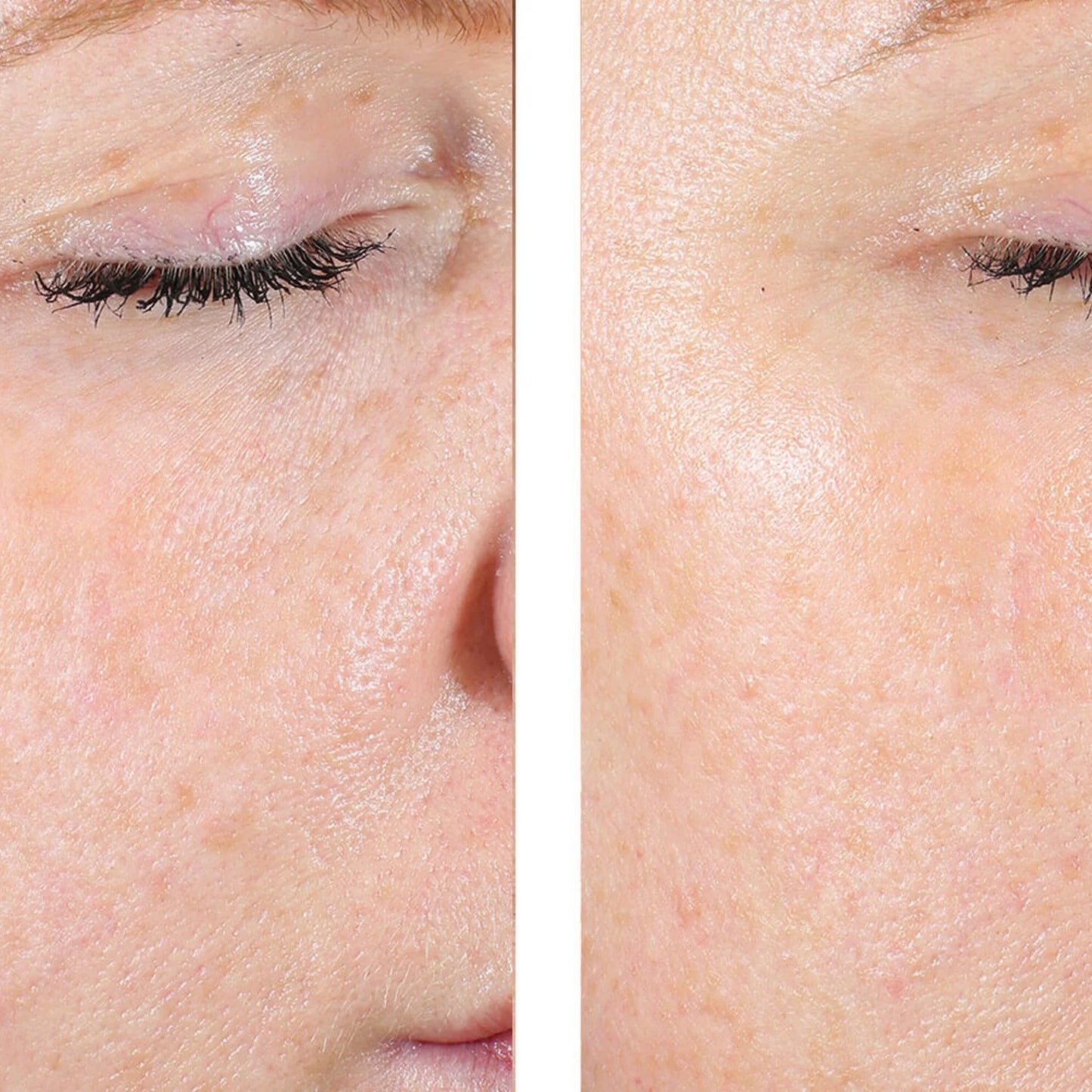 A close-up before-and-after style comparison of an eye and surrounding facial skin, showing a visible lash lift or lash enhancement on the left side and a smoother, darker lash line on the right side.