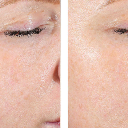 A close-up before-and-after style comparison of an eye and surrounding facial skin, showing a visible lash lift or lash enhancement on the left side and a smoother, darker lash line on the right side.