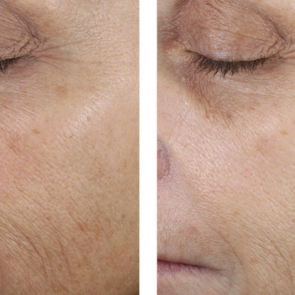Close-up before-and-after style comparison of a person's cheek and eye area, showing skin texture and wrinkle appearance.