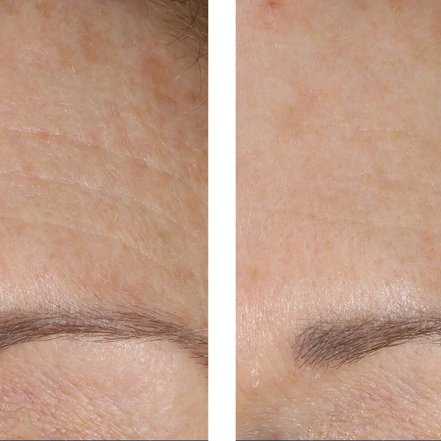 A side-by-side close-up comparison of an eyebrow, showing a lighter, sparser brow on the left and a fuller, darker brown brow on the right.